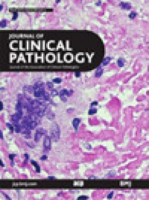Journal Of Clinical Pathology雜志